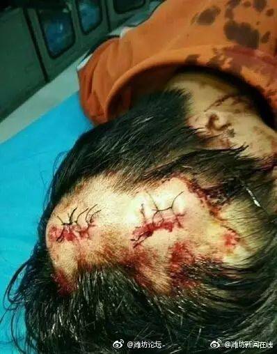 香港今晚开奖结果开奖记录和开门拿快递被绑架与开门拿快递被绑架怎么办